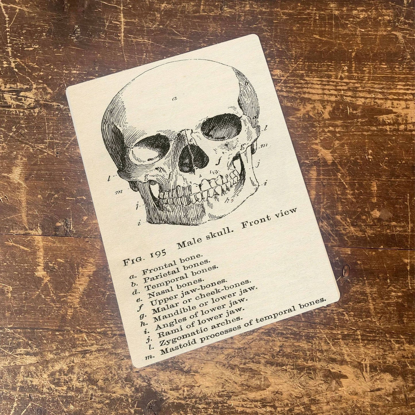 Male Skull Anatomy Head | Metal Advertising Wall Sign