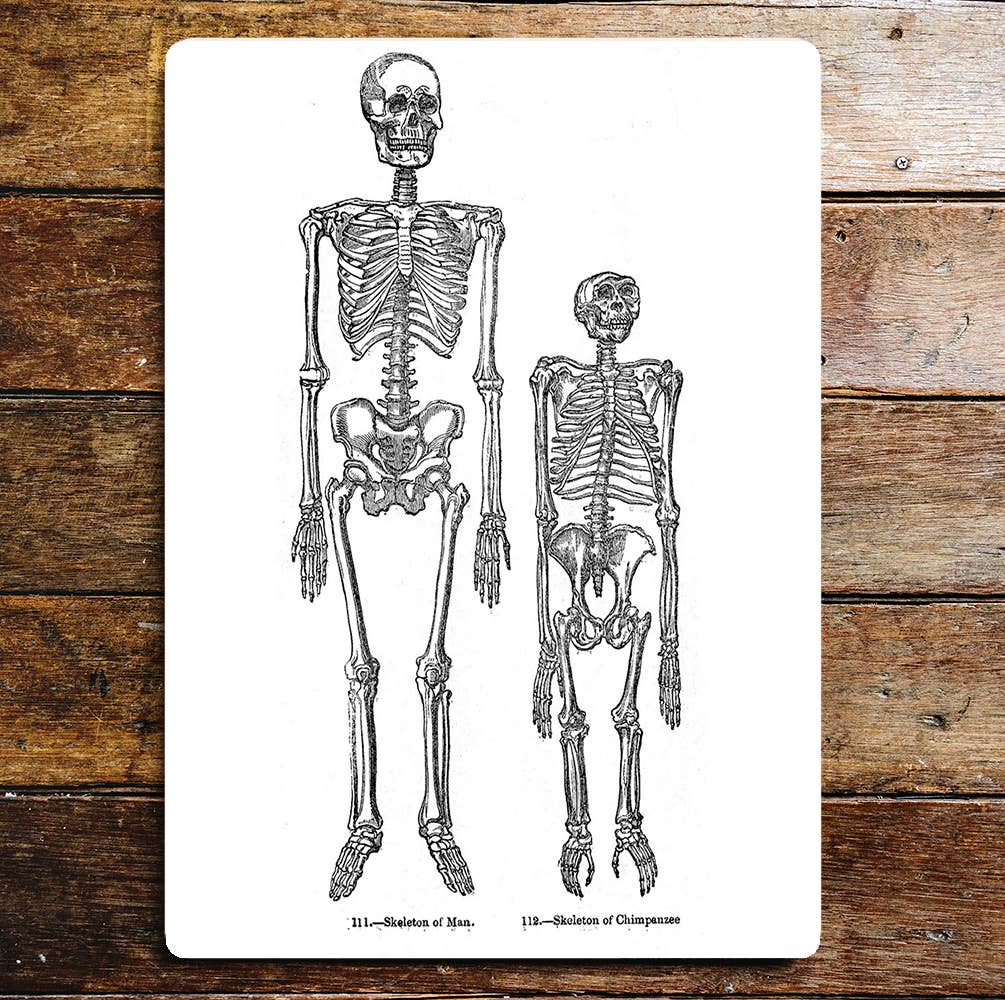 Skeleton Of Man & Skeleton Of Chimpanzee Metal Sign Plaque