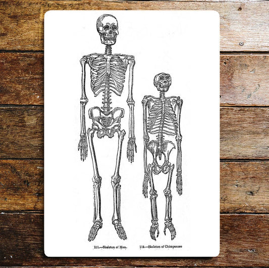 Skeleton Of Man & Skeleton Of Chimpanzee Metal Sign Plaque