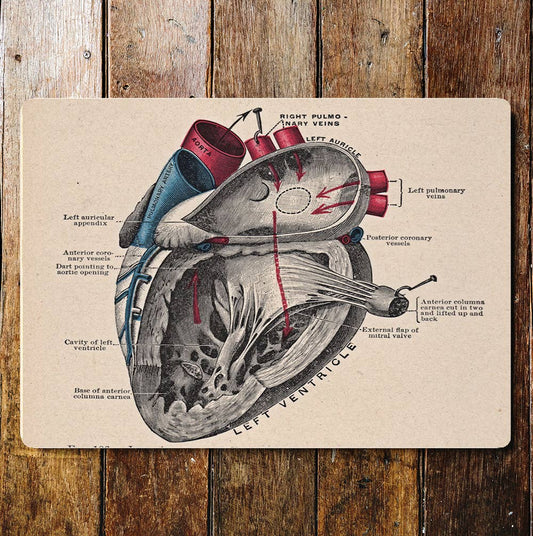 Left Ventricle Human Body | Metal Sign Plaque